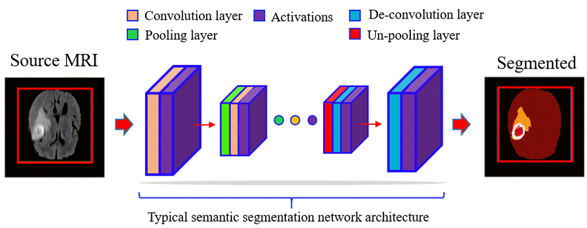 Typical process of segmentation with Deep Learning with a Convolutional Neural Network (CNN) based model is learned that first compresses the source image with a stack of different convolution, activation and pooling layers.