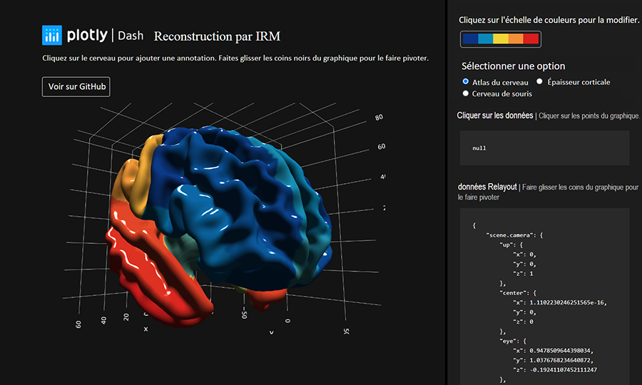 Figure 11 - Interface utilisateur Dash avec un composant pour la visualisation de maillages 3D